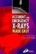 Foto Accident and emergency x-rays made easy (en papel)