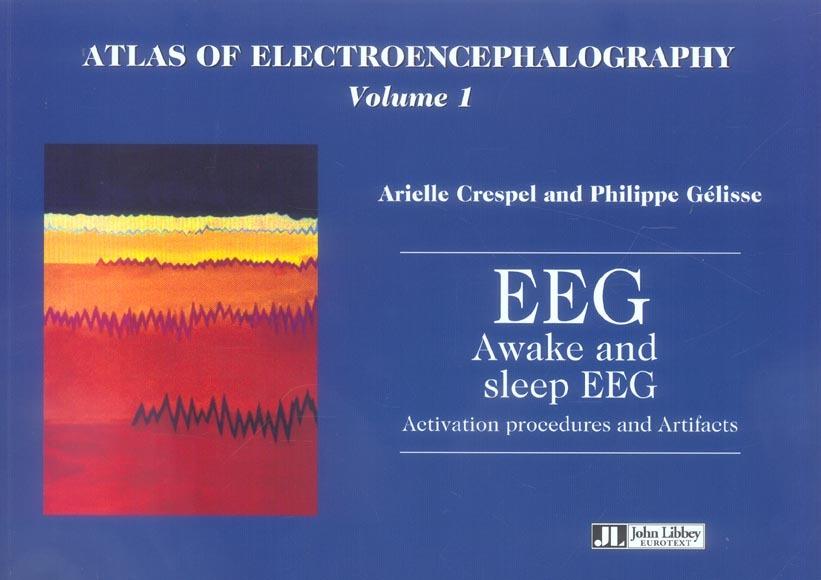 Foto Atlas of electroenphalography t.1