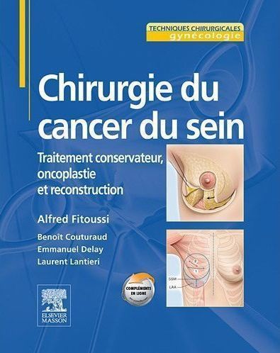 Foto Chirurgie du cancer du sein