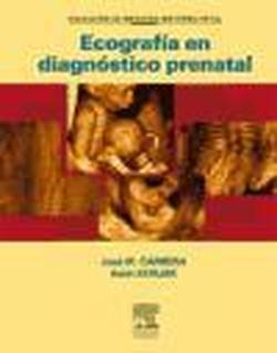 Foto Ecografía en diagnóstico prenatal