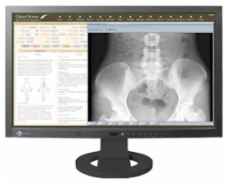 Foto EIZO RadiForce MS230W-BK