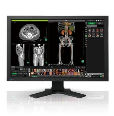 Foto Eizo radiforce mx241w