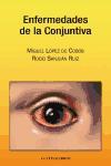 Foto Enfermedades De La Conjuntiva