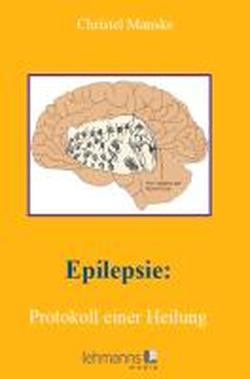 Foto Epilepsie: Protokoll einer Heilung