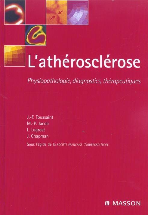 Foto L' atherosclerose : physiopathologie, diagnostics, therapeutiques