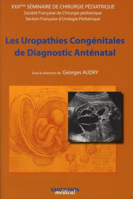 Foto Les uropathies congenitales de diagnostic prenatal