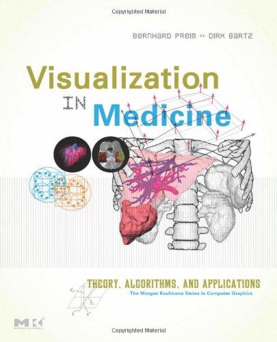 Foto Visualization in Medicine: Theory, Algorithms, and Applications (The Morgan Kaufmann Series in Computer Graphics)