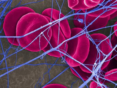 Foto Lámina fotográfica Red Blood Cells (Erythrocytes) Within a Dense Network of Fibrin Fibers in a Blood Clot, SEM X7000 de Stanley Flegler, 61x46 in. foto 589219