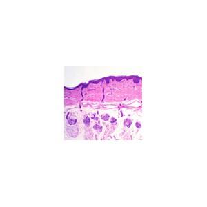 Foto Piel humana, glandulas sudoriparas, sec. foto 84636